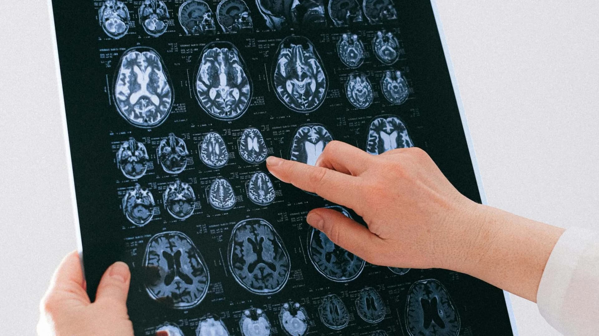 ¿Cómo Ejercitar la Mente? Importancia de Mantener el Cerebro en Forma